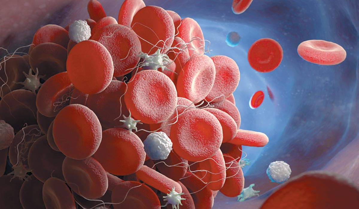 antifosfolipidni-sindrom-knjizica