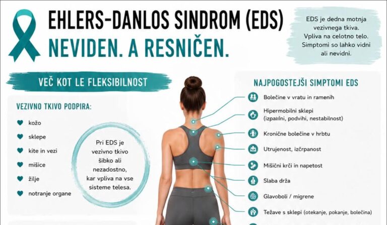 eds-sindrom-naslovna